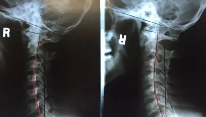 X-Ray