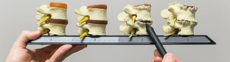 image of vertebrae model with text Spine Degeneration Spinal Works Moon Valley North Phoenix, Chiropractic adjustment